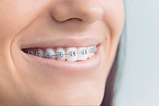 Why Choose Us for Your Dental Needs in Montclair State University, NJ